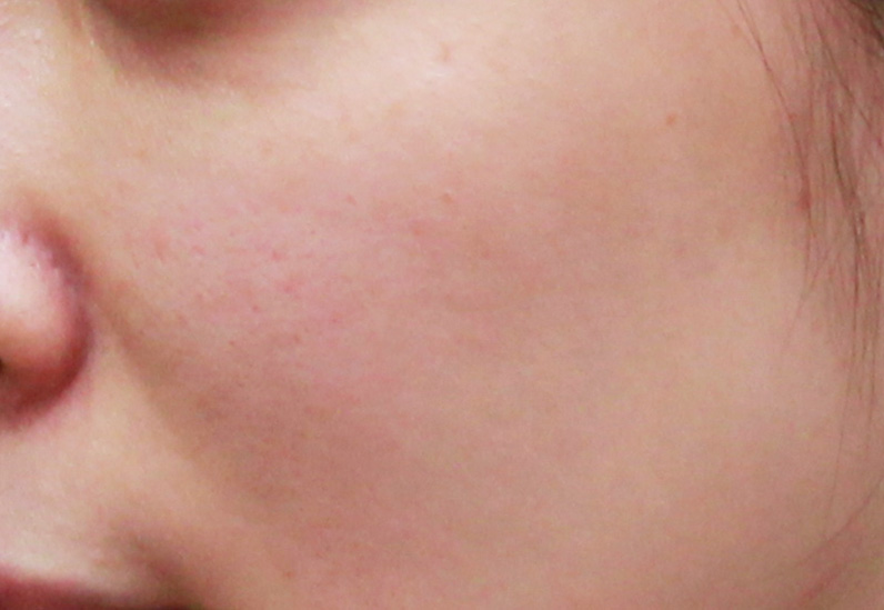 Before image alt