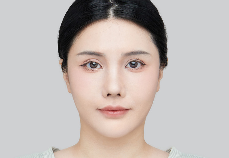 After image alt