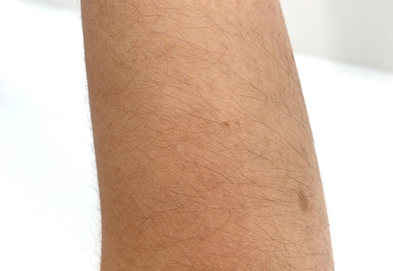 Before image alt