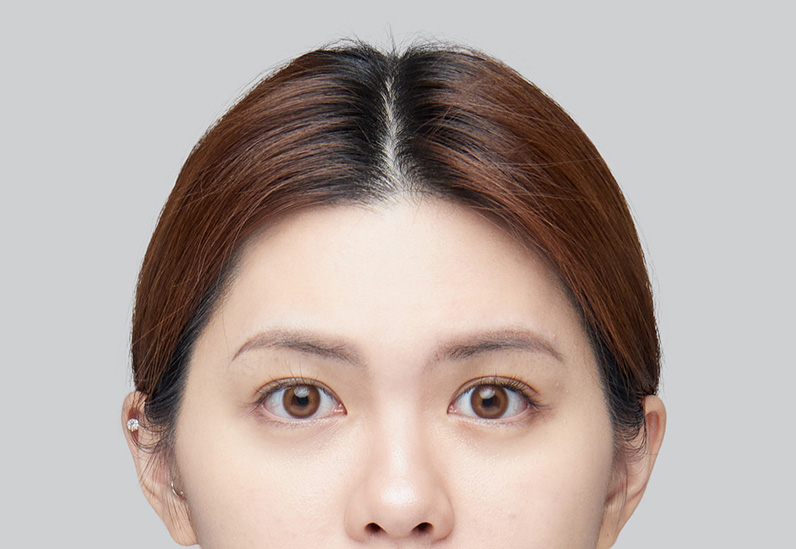After image alt