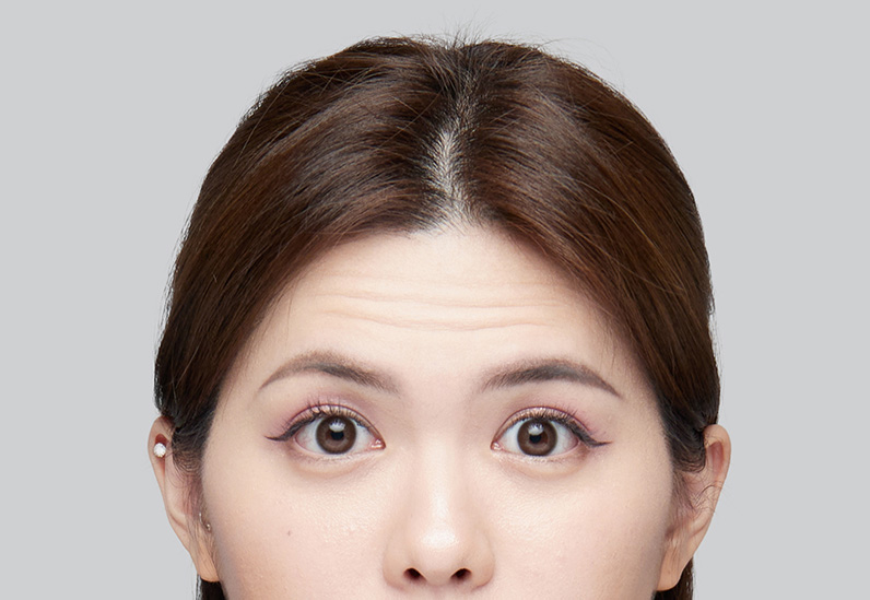Before image alt