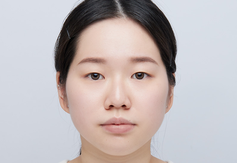 Before image alt