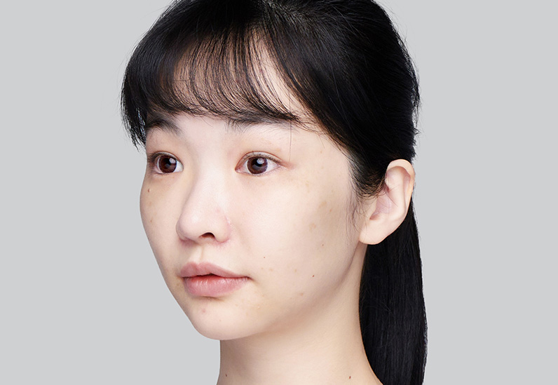Before image alt